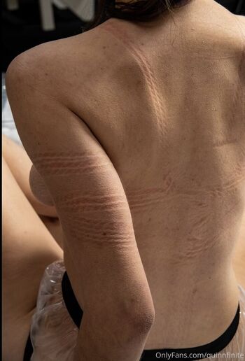 Quinn finite  page leaked private photo uncensored HD quality